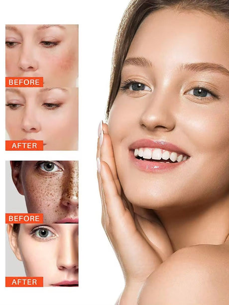 EYANG Whitening Anti-Freckle Cream 50g