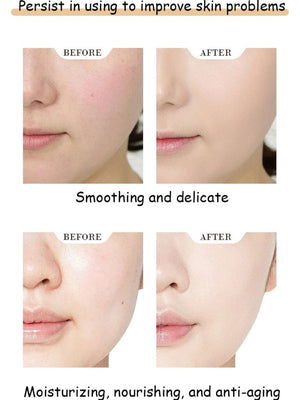 Yiyang Forest Mask Series-Avocado 25ml*5 pieces