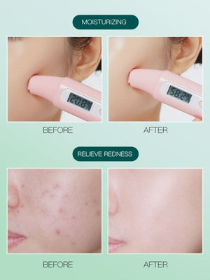 Zhibei Calendula Chamomile Essence Soothing Mask 28ml*10 pieces