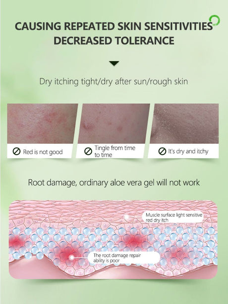 Zhibei After-sun Repair Aloe Vera Gel 300ml